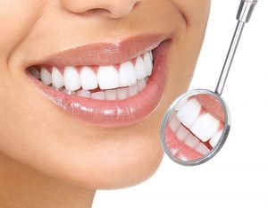 Blanqueamiento dental - Sonrisa